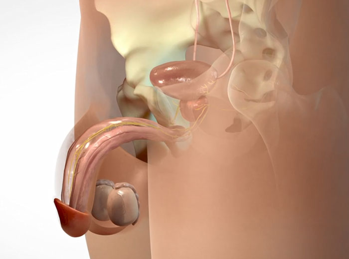Managing Erectile Dysfunction After Cancer: More Than Penile Rigidity